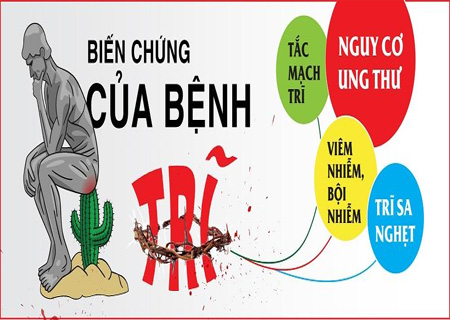 Trĩ nội gây ra nhiều biến chứng nguy hiểm