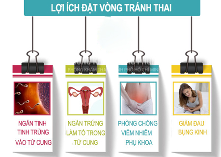 Đặt vòng tránh thai có nhiều lợi ích hiệu quả