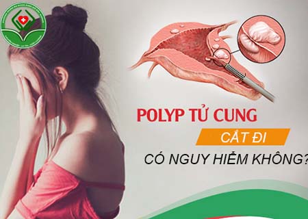 Chữa polyp cổ tử cung ở bắc giang