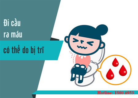 Đi ngoài ra máu - cần dè chừng những bệnh lý nguy hiểm