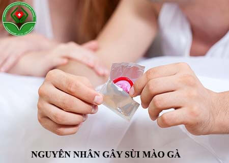 nguyên nhân gây bệnh sùi mào gà nguyên nhân gây bệnh sùi mào gà