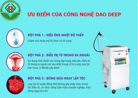 ưu điểm của công nghệ RFA