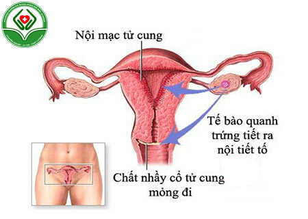 Viêm nội mạc tử cung là gì?