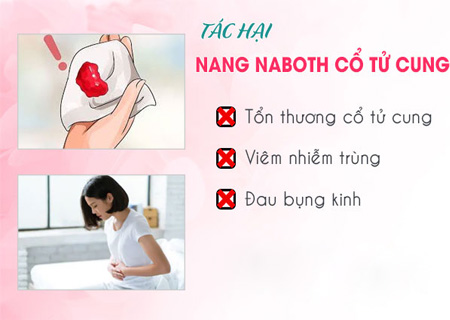 Naboth tử cung gây ra các biến chứng vô cùng nguy hiểm 