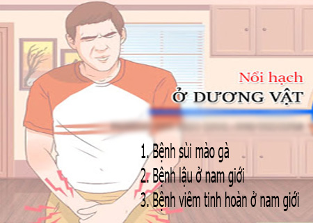 Nổi hạt, nổi cục, nổi hạch dương vật là dấu hiệu của nhiều bệnh nguy hiểm