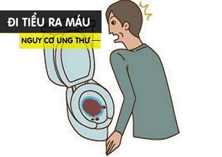 Tiểu ra máu gây nhiều biến chứng nguy hiểm