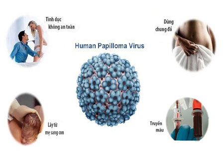 Nguyên nhân gây nhiễm HPV