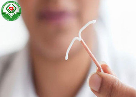 Tìm hiểu đặt vòng tránh thai là gì