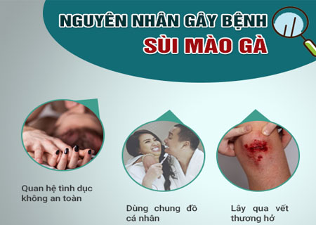 Nguyên nhân gây sùi mào gà ở nam giới