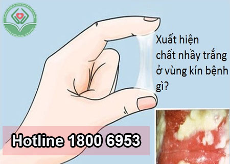 Ra dịch trắng vùng kín nữ cảnh báo nhiều bệnh lý