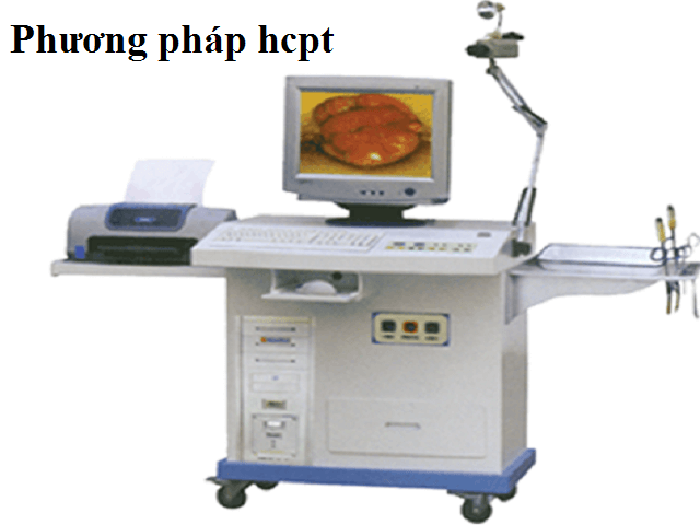 điều trị lòi dom bằng phương pháp HCPT