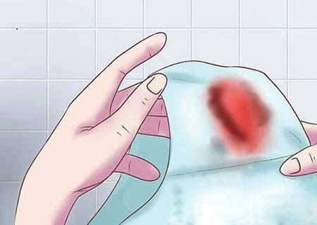 Điều trị ra khí hư màu nâu kèm theo máu
