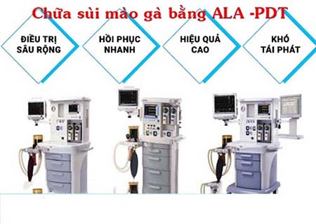 phương pháp ala - pdt