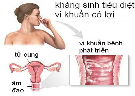 tại sao bệnh phụ khao hay tái phát