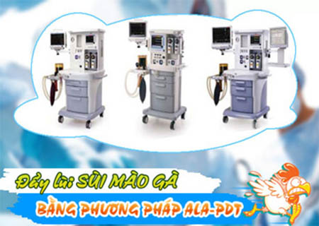 phương pháp điều trị sùi mào gà an toàn và hiệu quả