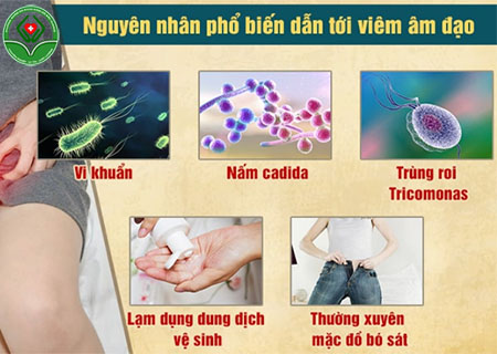 Nguyên nhân gây nấm âm đạo