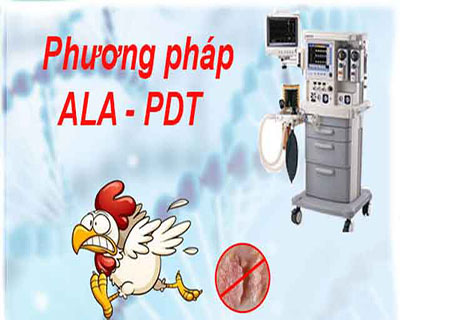 Thời gian đốt sùi mào gà mất bao lâu