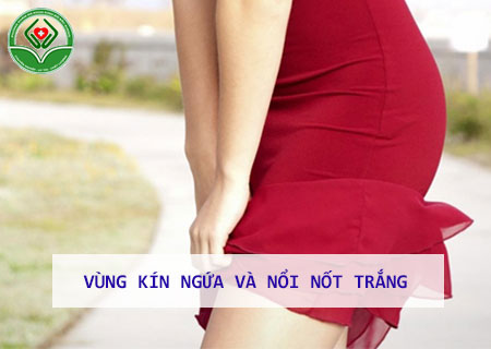 vung-kin-ngua-va-noi-not-trang