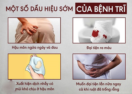 Bệnh trĩ có nhiều dấu hiệu cụ thể mà người bệnh có thể nhận biết được