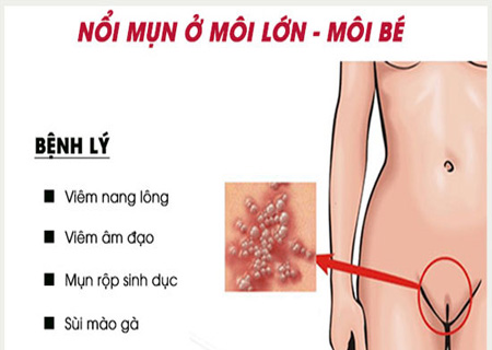 Bị sần sùi ở môi bé cảnh báo nhiều căn bệnh nguy hiểm