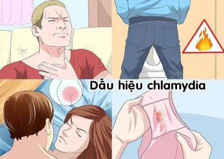 Chlamydia có thể nhận biết qua nhiều dấu hiệu cụ thể