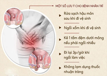 Người bị bệnh trĩ giai đoạn đầu nên lưu ý để có phương án điều trị hiệu quả