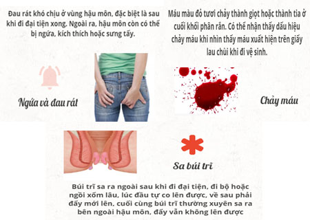 Biểu hiện của bệnh trĩ ở nữ giới