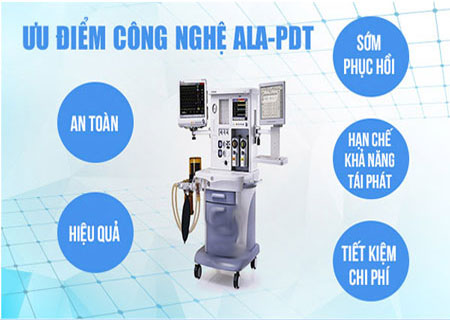 Phương pháp ALA - PDT chữa sùi mào gà hiệu quả