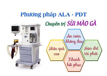 Phương pháp điều trị sùi mào gà ở dương vật hiệu quả
