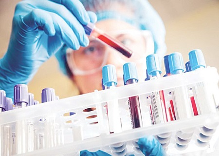 Xét nghiệm chlamydia hết bao nhiêu tiền Xét nghiệm chlamydia hết bao nhiêu tiền