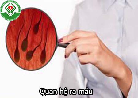 Quan hệ ra máu