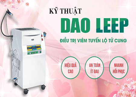 Chữa viêm lộ tuyến bằng phương pháp RFA