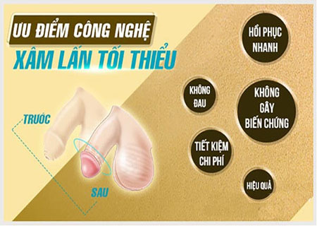 Cắt bao quy đầu kiểu Hàn