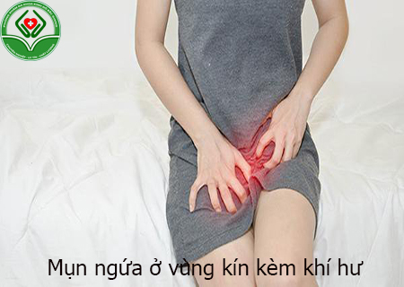 mụn ngứa ở vùng kín kèm khí hư