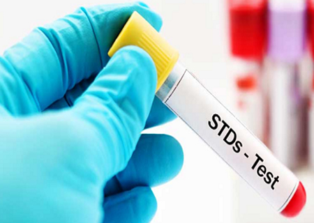 Kiểm tra STDs là việc làm cần phải thực hiện thường xuyên