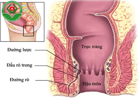 Điều bạn cần biết về bệnh mạch lươn