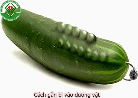 Cách gắn bi vào dương vật