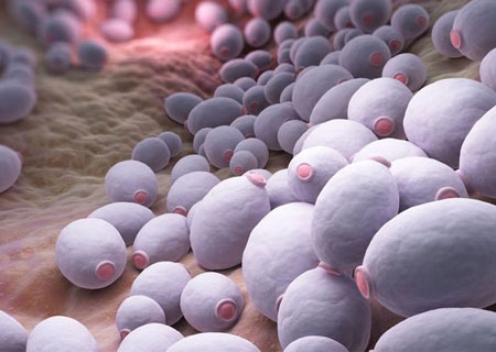 Nấm Candida âm đạo cần phải điều trị trong thời gian sớm nhất