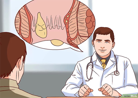 Nấm Candida cần phải được thăm khám và điều trị cẩn thận