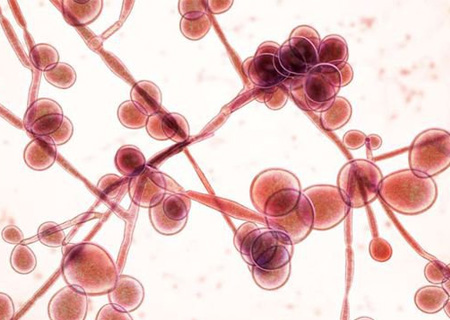 Nấm Candida gây viêm nhiễm tại vùng kín