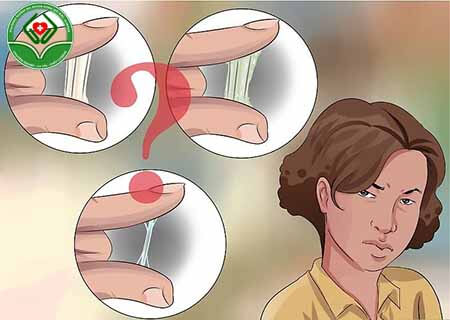 Triệu chứng của bệnh nấm Candida âm đạo
