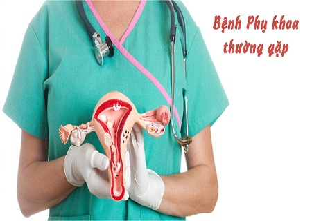 Các bệnh phụ khoa thường gặp ở nữ giới