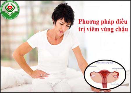 Phương pháp điều trị viêm vùng chậu