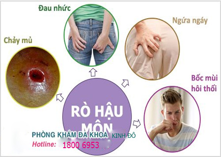 Rò rỉ hậu môn là biểu hiện của nhiều bệnh nguy hiểm