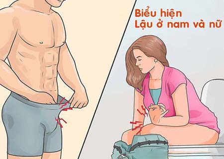 Dấu hiệu của bệnh lậu