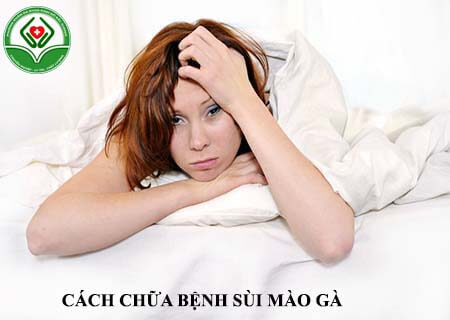 cách chữa bệnh sùi mào gà