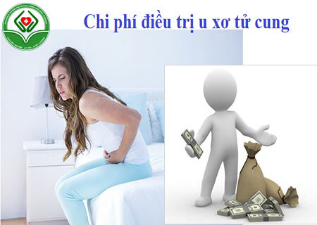 Chi phí điều trị u xơ tử cung