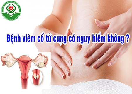 Tác hại của bệnh viêm cổ tử cung