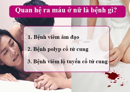 Quan hệ ra máu ở nữ là bệnh gì