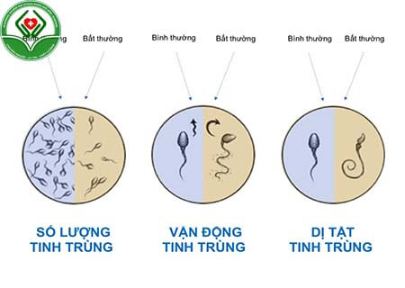 Đặc điểm tinh trùng của người bị lậu